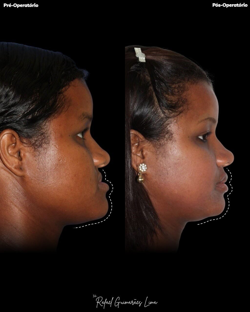 Instagram post from rafaelguimaraeslima. This post is in position 1.