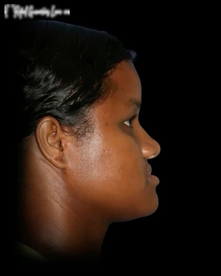 Instagram post from rafaelguimaraeslima. This post is in position 2.