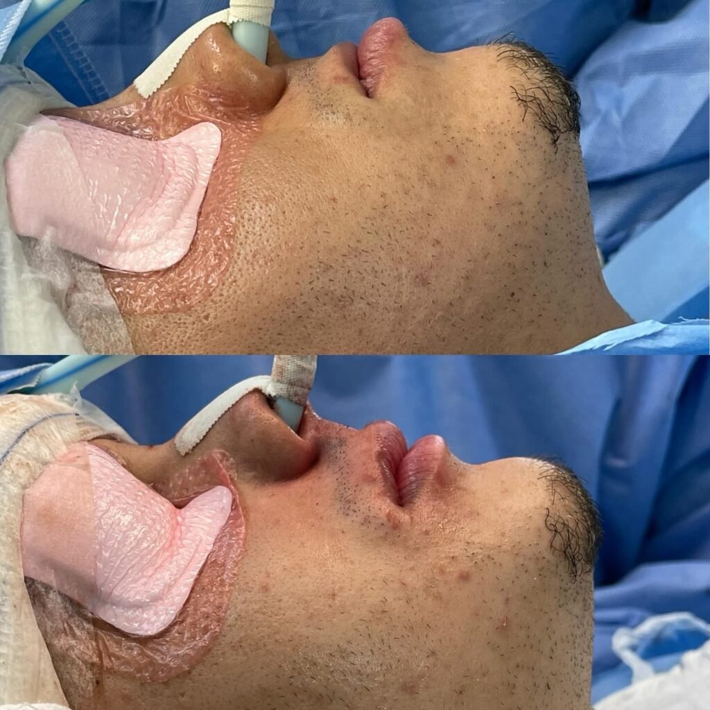 Instagram post from rafaelguimaraeslima. This post is in position 3.